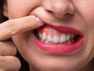 Cơ địa và di truyền của bệnh nhân ảnh hưởng đến mức độ gây dị ứng