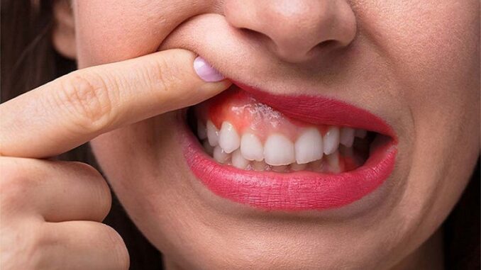 Cơ địa và di truyền của bệnh nhân ảnh hưởng đến mức độ gây dị ứng