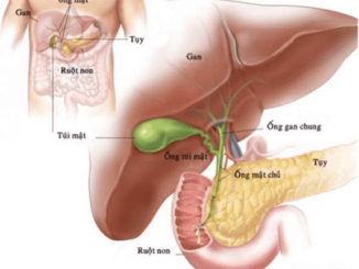 Các phương pháp chẩn đoán sỏi túi mật