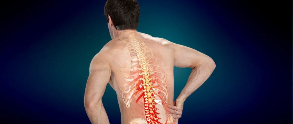 Thoát vị đĩa đệm