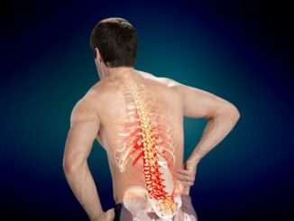 Thoát vị đĩa đệm